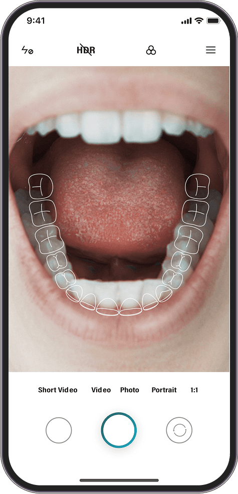 치아, 딱 맞게 촬영
